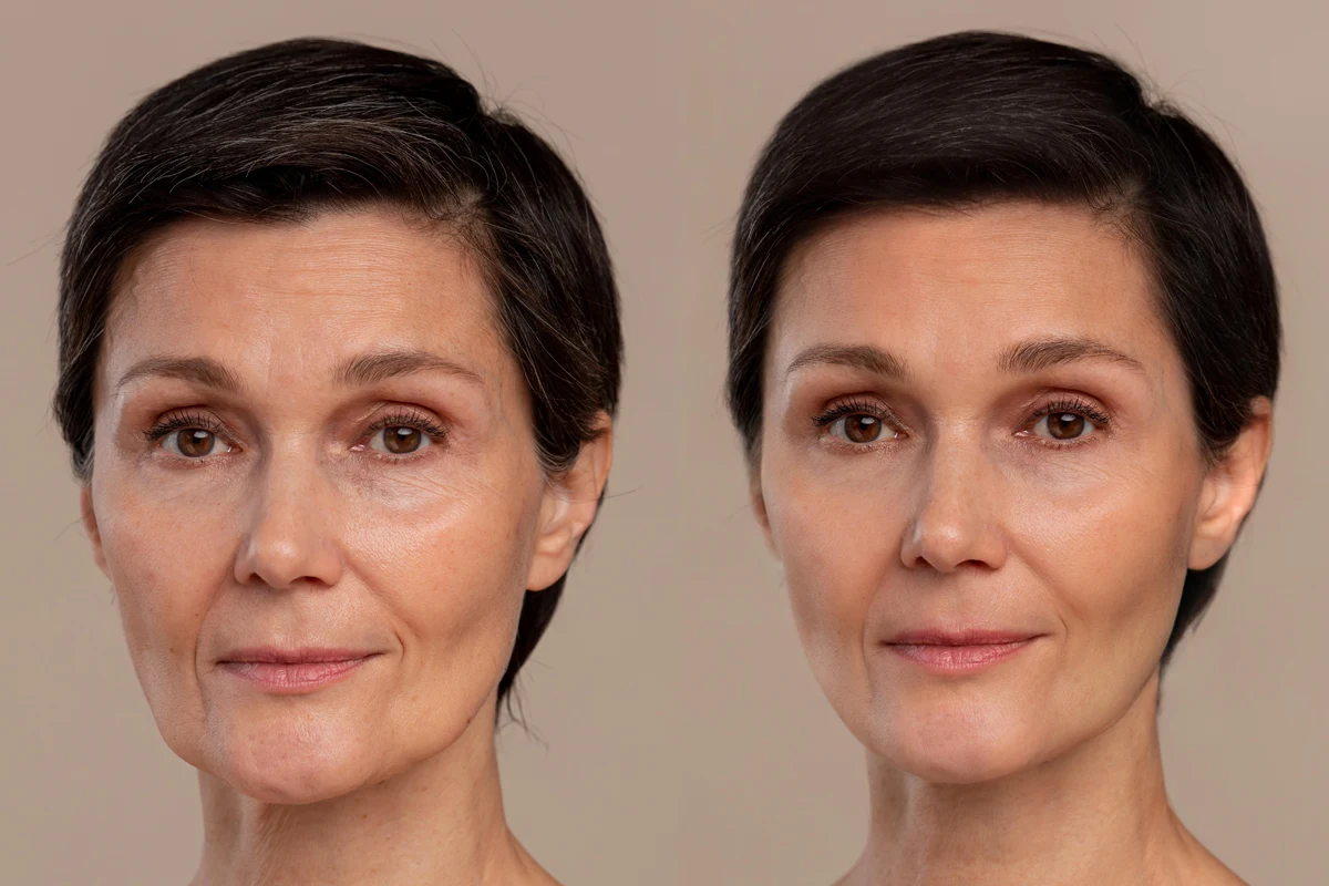 antiagingdriptherapy