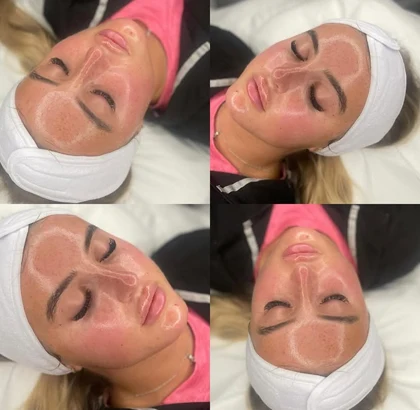 facial 1