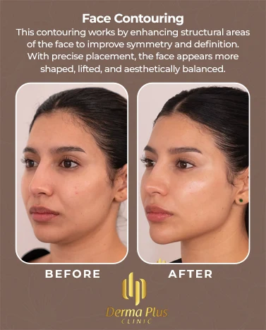 facecontouringbeforafter