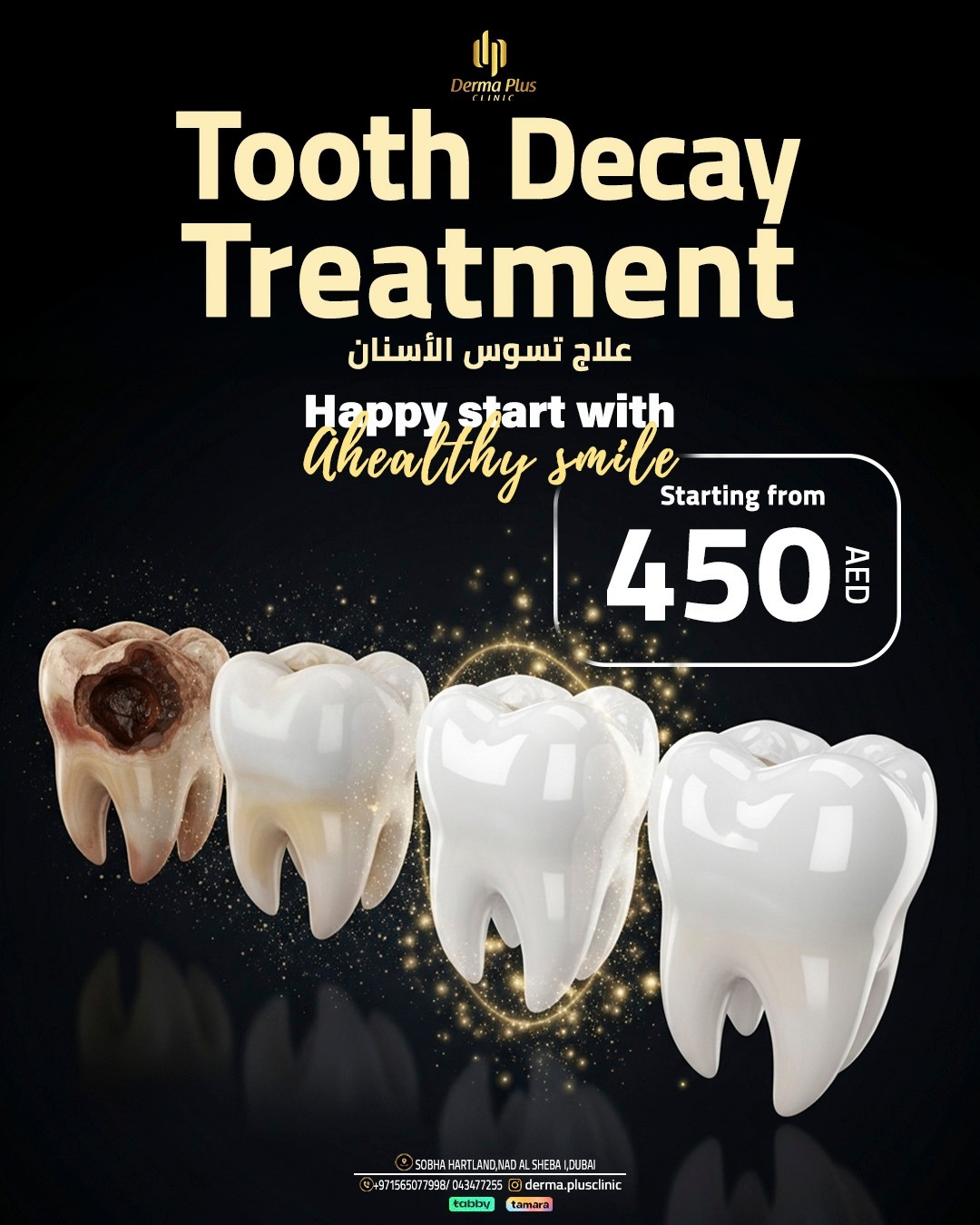 toothdecaytreatment